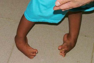 Childrens Podiatry