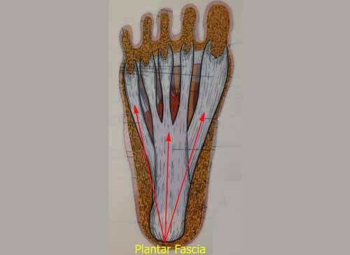 Foot Arch Pain Inflammation Treatment