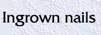 ingrown nails